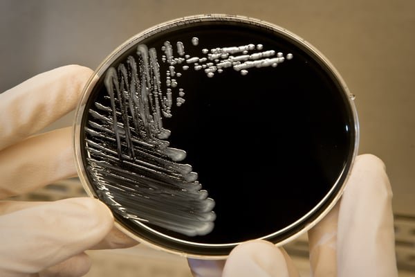 Water Quality and Legionella Control